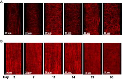 Postnatal development of extracellular matrix and vascular function in small arteries of the rat